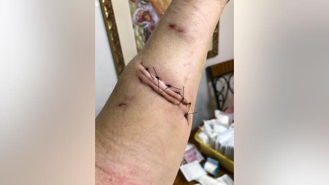 WARNING GRAPHIC IMAGES: Woman mauled by pit bull in Vallejo