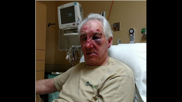 Elderly man beaten following road rage incident near East Bethel, Minn.