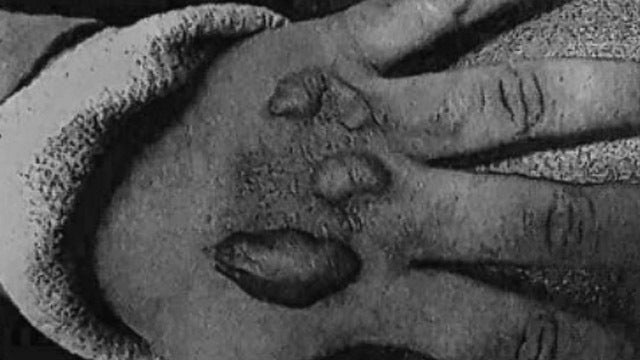 Father accused of putting 6-year-old daughter's hand over stove flame as punishment