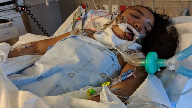 Dallas hit-and-run victim has emergency surgery after stroke
