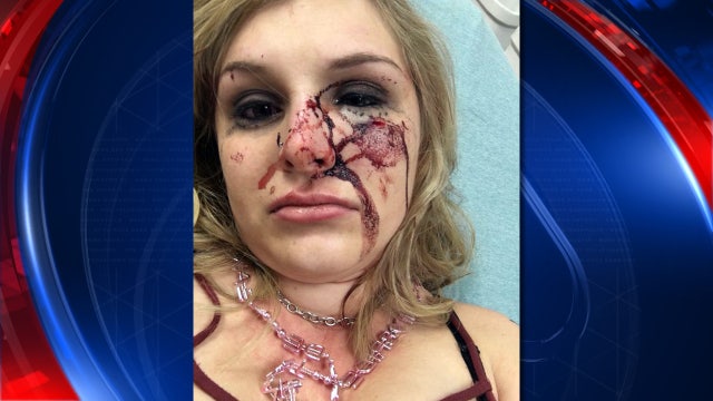 With now-viral post, woman hunts bar assailant