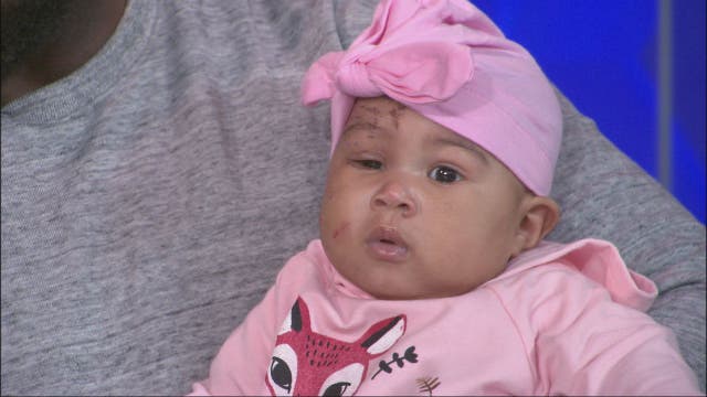 Infant home for the holidays after raccoon attack, outpouring of donations