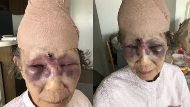 Suspect sought after 86-year-old grandmother attacked