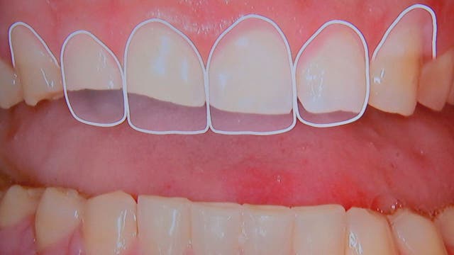 Wake up with a headache?  This may be why.