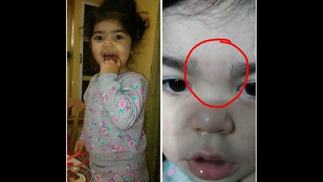 Mother claims daycare waxed daughter's unibrow