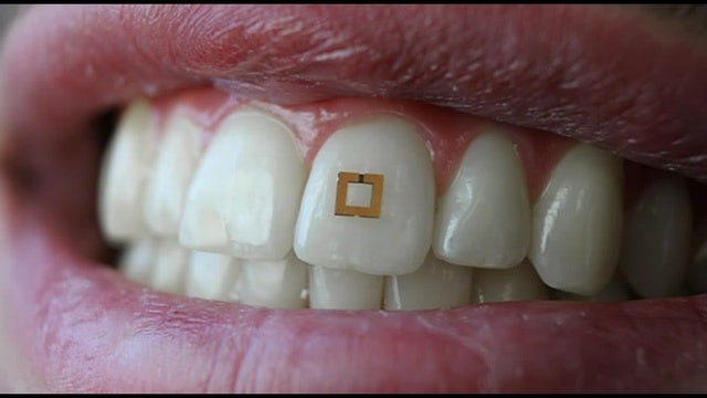 Tooth sensor tracks what you put inside your mouth