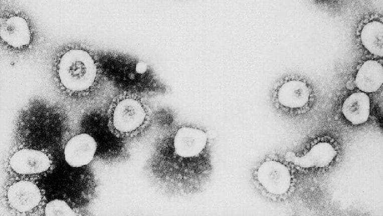 This undated handout photo from the Centers for Disease Control and Prevention shows a microscopic view of the Coronavirus at the CDC in Atlanta, Georgia. (Photo by CDC/Getty Images)