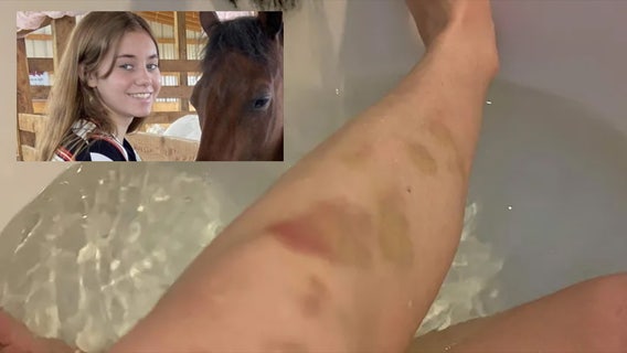 Family of bullied NJ teen who committed suicide preparing to sue school district