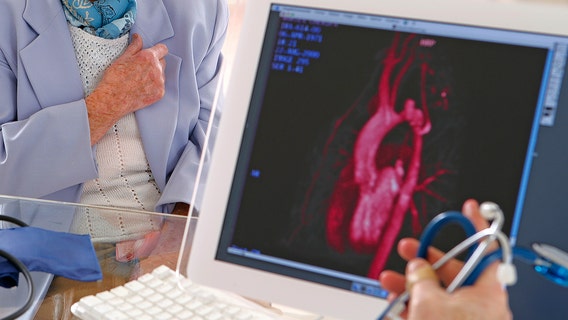 Heart disease risk could be affected by one surprising factor, new study finds