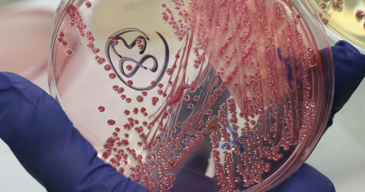 4 children confirmed to have E. coli, 2 more sick after Whatcom County ...