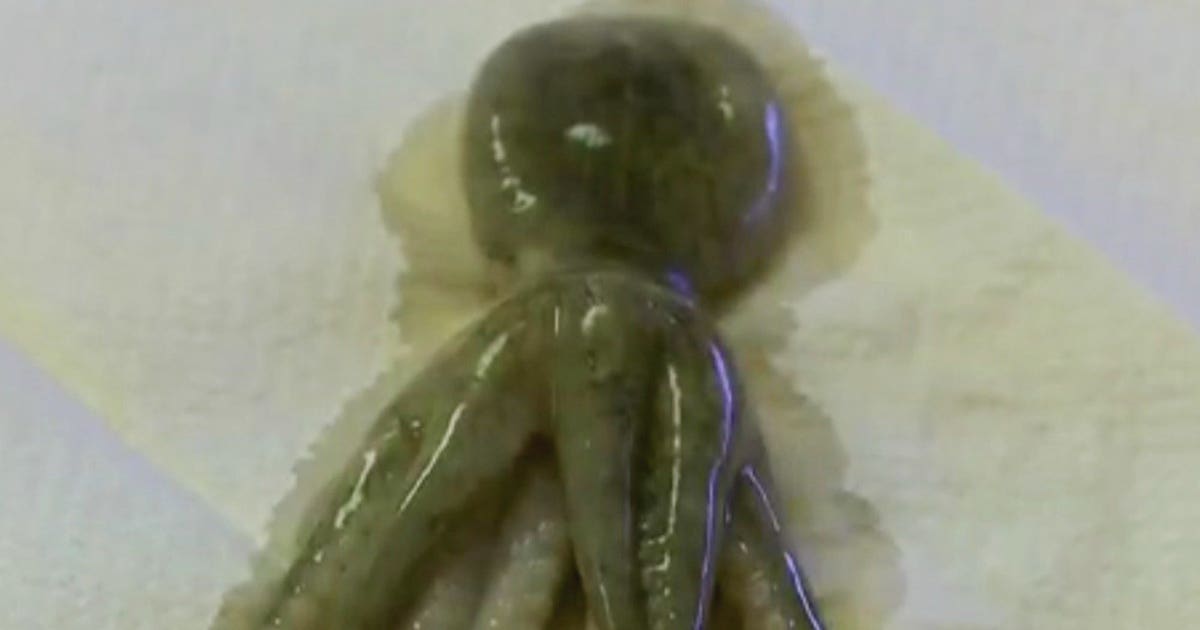 Octopus Mutilation Octopus removed from 2-year-old's throat; child abuse charges filed ...