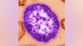 Health officials warn of possible measles exposure at Seattle urgent care