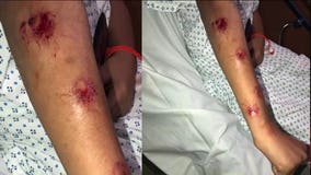 Man ambushed boy, shot him over 20 times with paintball gun, family says