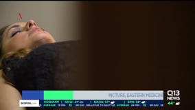 An Eastern medicine approach to treating infertility