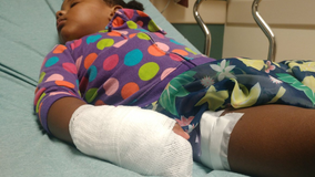 Parents say Little Caesars pizza left 2-year-old with second-degree burns