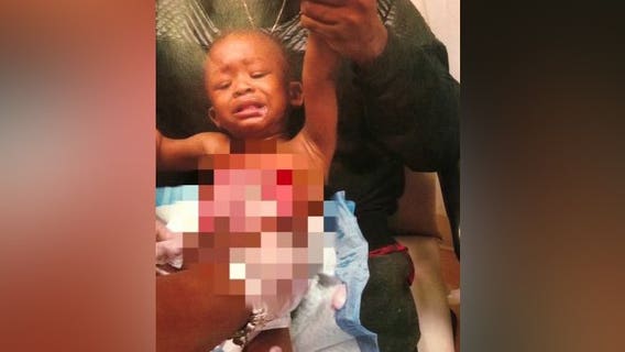Family to sue Applebee’s after baby burned by steaming water