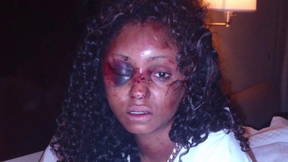 Woman shares details of assault during date with man she met on Instagram