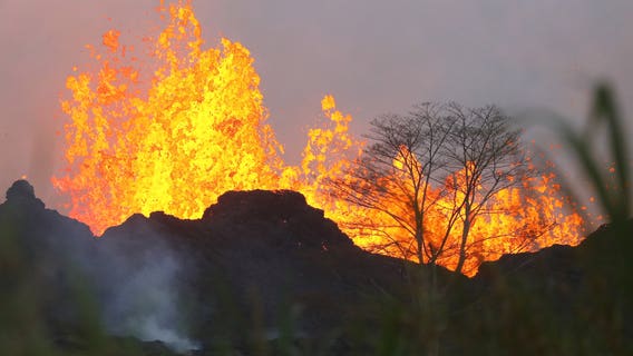 First major injury from Hawaiian volcano reported