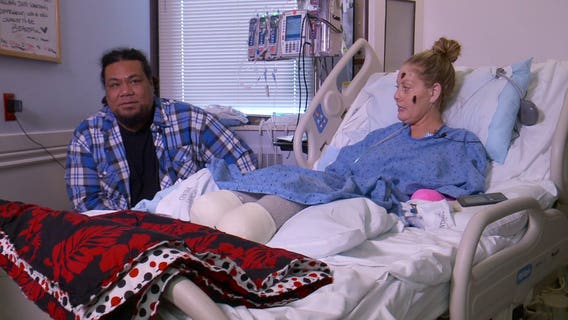 'I just have to go with it': Utah mother stays positive after quadruple amputation