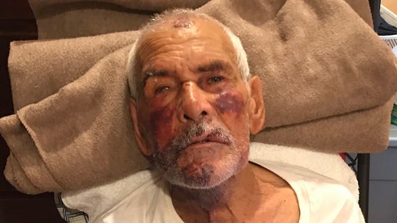 Woman charged with attempted murder in brick beating of 92-year-old grandfather