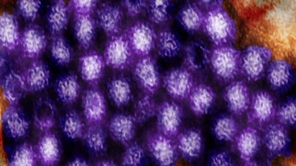 Dozens of students sick in possible norovirus outbreak in Gig Harbor, WA
