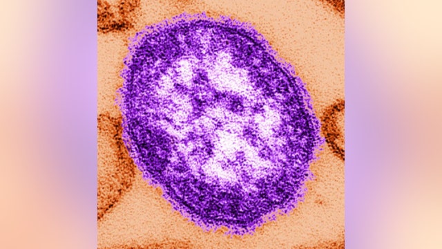 Health officials warn of possible measles exposure at Seattle urgent care