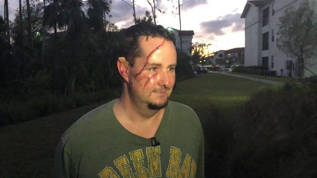 Bear attacks man who let his dog out for a walk