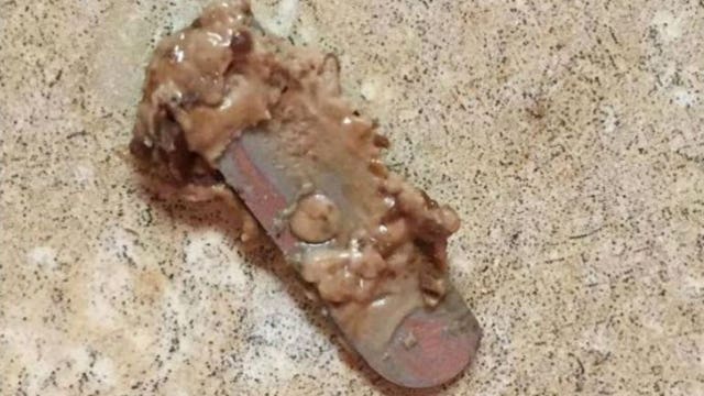 13-year-old injured after biting into razor hidden in Halloween candy bar, mom says