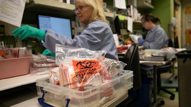 Washington coronavirus death toll reaches 81 as number of cases in state tops 1,500