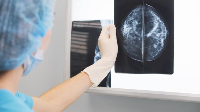 Washington state sues fake breast cancer charity; wins $500,000