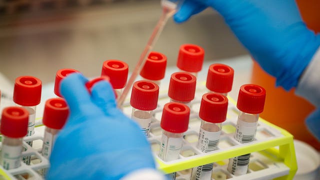 Large-scale antibody testing could come to Washington
