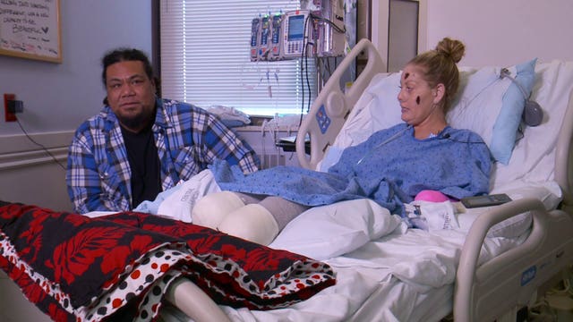 'I just have to go with it': Utah mother stays positive after quadruple amputation