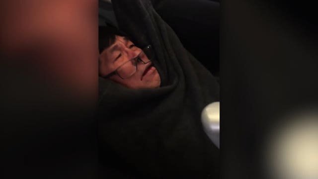 Lawyer says man dragged off plane has concussion, lost teeth