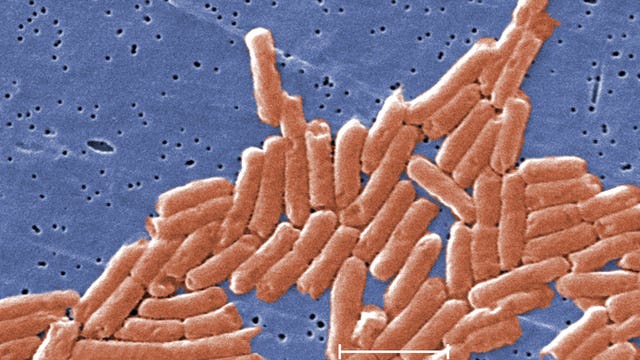 Salmonella outbreak at Washington Care Center: 29 confirmed cases