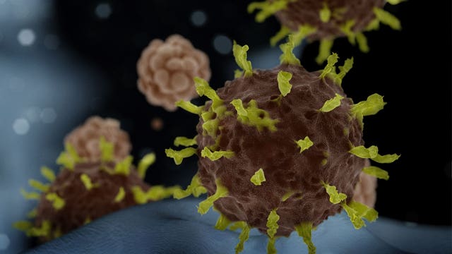 California woman with unknown origin of coronavirus is in serious condition