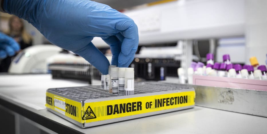 Gates Foundation to soon offer home-testing kits for coronavirus in Seattle area