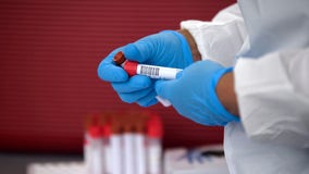 37 at SeaTac federal detention center infected with coronavirus