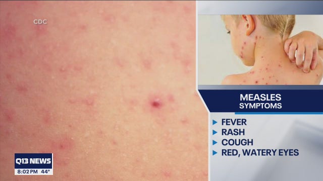 Health officials warn of possible measles exposure at Seattle-Tacoma International Airport
