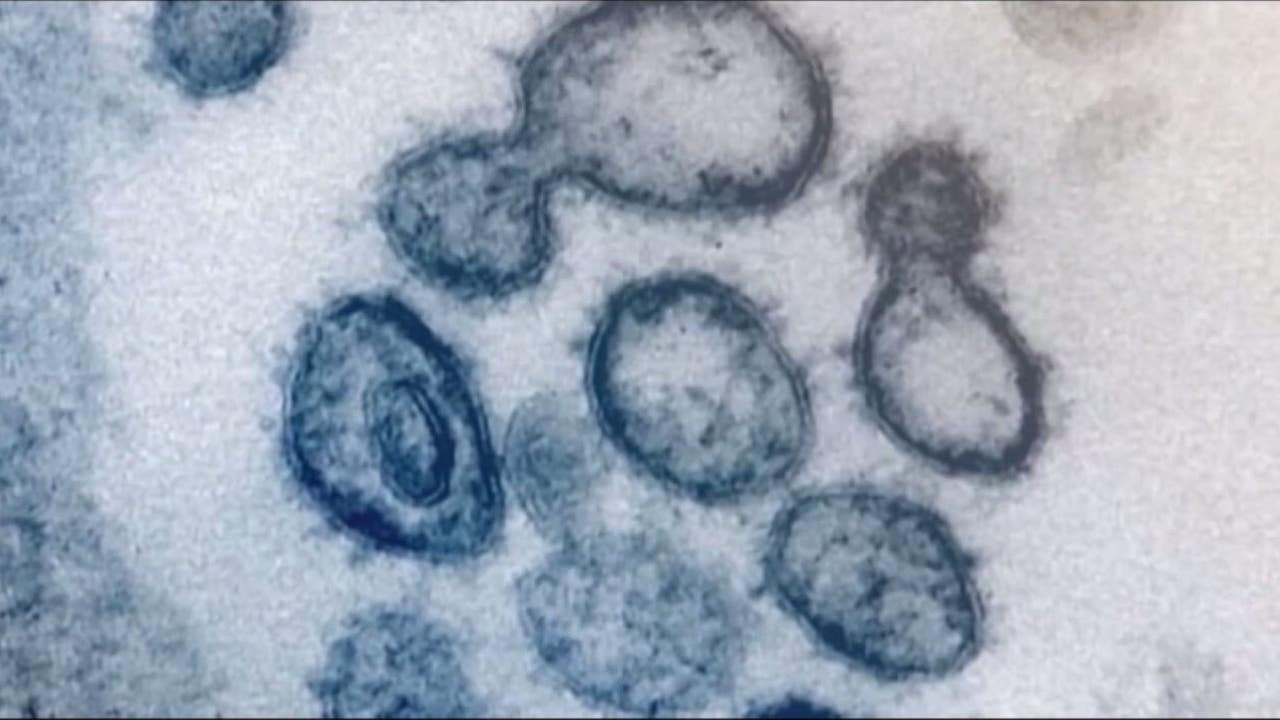 King County crosses threshold for CDC’s ‘yellow’ COVID-19 level – FOX 13 Seattle King County crosses threshold for CDC’s ‘yellow’ COVID-19 level – FOX 13 Seattle