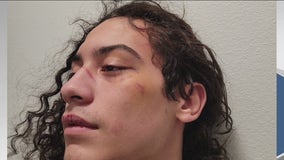 Teen pistol-whipped during violent road rage incident in Pierce County