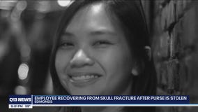 Edmonds cafe worker recovering from skull fracture after trying to stop purse snatcher