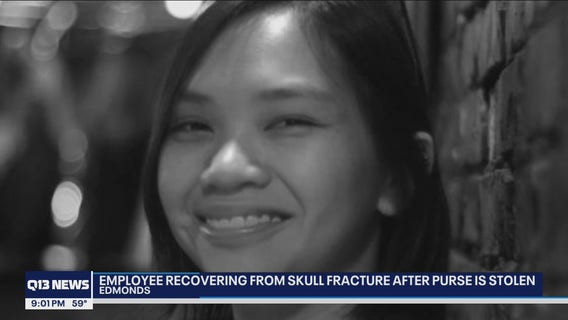 Edmonds cafe worker recovering from skull fracture after trying to stop purse snatcher