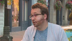 'This is what happens when you don't try to take care of the city:' Man stabbed while walking dogs speaks out