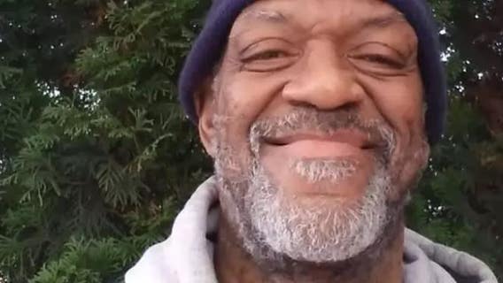 All this former NBA star experiencing homeless wants is a set of new teeth
