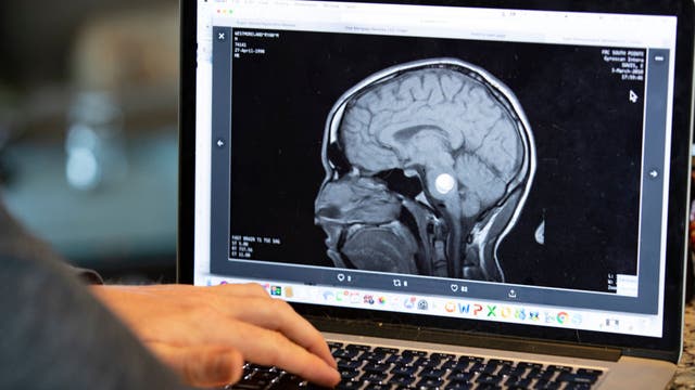 Know the warning signs of stroke