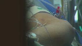 COVID spread putting 'serious stress' on state hospital system already at capacity