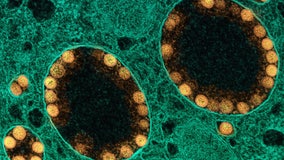 WSU researchers discover 'COVID-like' virus immune to current vaccines