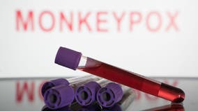 Monkeypox cases declining in Washington, outbreak trajectory unclear