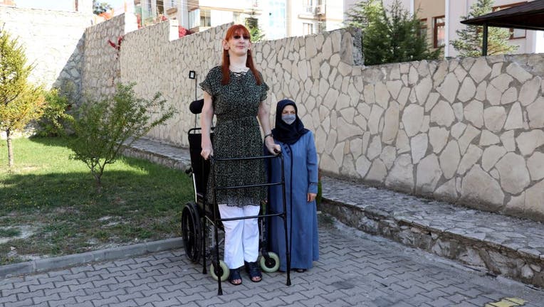 The world's tallest living woman 24-year-old Rumeysa Gelgi lives in Turkey's Karabuk