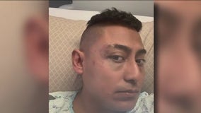 Court docs: Man beaten, threatened for being Mexican over $40, weed